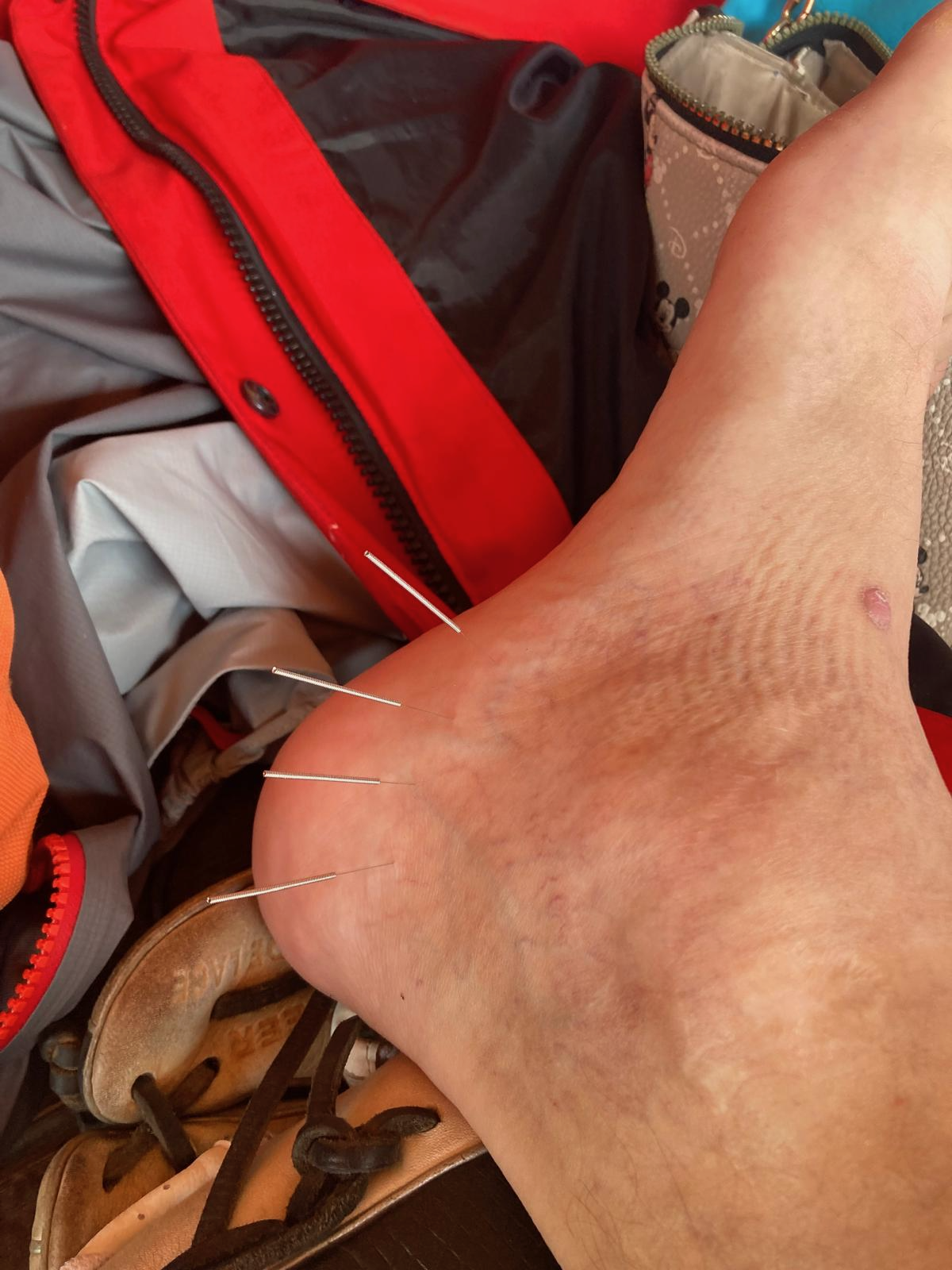 Krígeľ 2025: Dudyho akupunktura